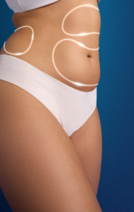 Coolsculpting Elite